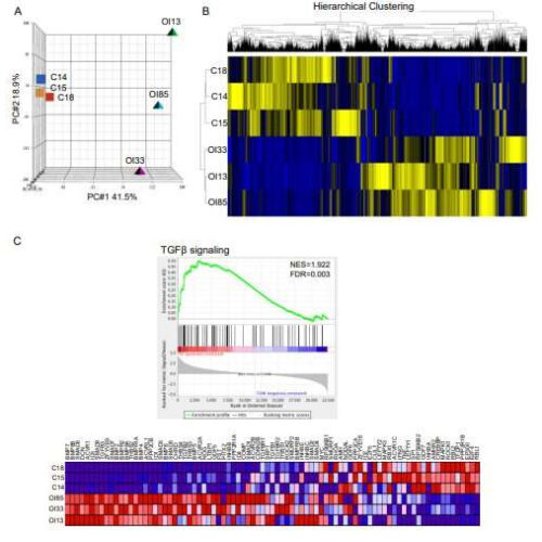 Targeting TGF-β for treatment of osteogenesis imperfecta