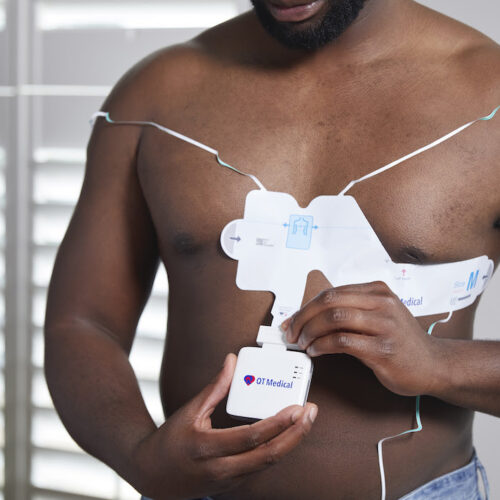 Royal Philips rolls out at-home ECG system for decentralized clinical trials