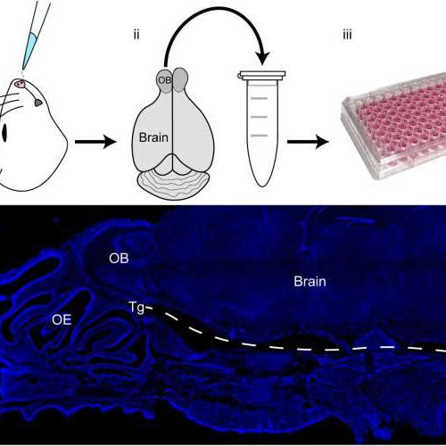 Bacteria in the nose may increase risk of Alzheimer’s disease