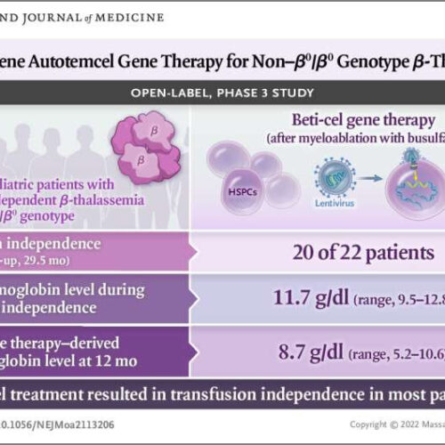 Gene therapy promotes transfusion independence for severe beta-thalassemia