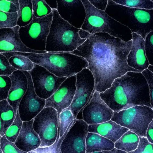 P53 protein plays a key role in tissue repair, study finds