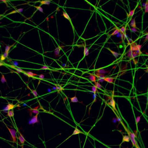 Scientists think a peptide could stop, reverse damage to nerve cells
