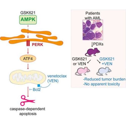 Defeating leukemia cells by depriving them of energy