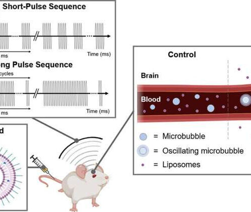 Non-invasive method to deliver drugs to the brain