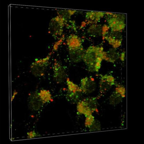 Discovery points to possible driver of Parkinson’s disease