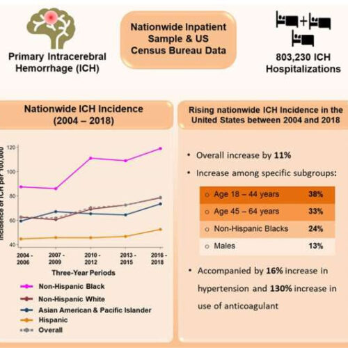 Deadly type of stroke increasing among younger and middle-aged adults