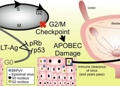 Study: Common virus may cause bladder cancer