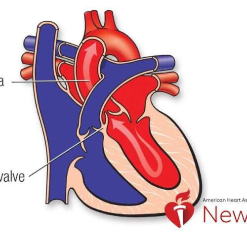 Death rates from tears in this major heart artery are rising, especially among women, black adults