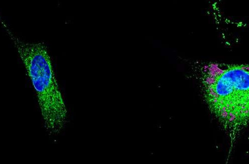 The role of lipids in the development of Alzheimer’s disease