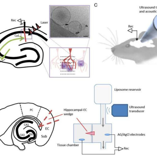 Research offers new hope for people living with seizures