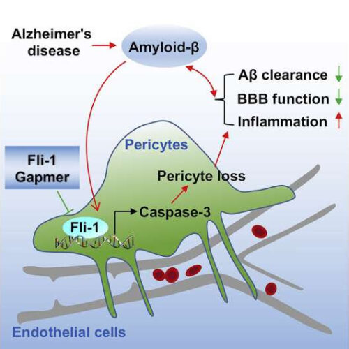 Suppression of Fli-1 protects against pericyte loss, could be new therapeutic target for Alzheimer’s