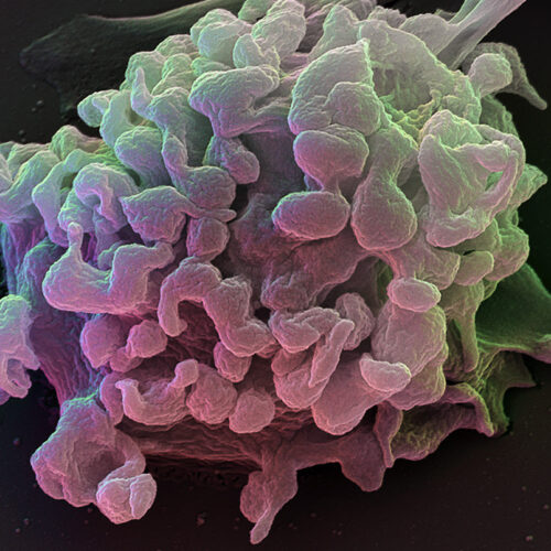 New class of killer T cells may prevent autoimmune diseases