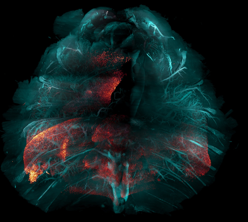 New method for making tissue transparent could speed the study of many diseases