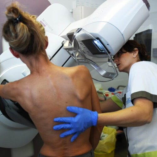 How often is breast cancer overdiagnosed? New research finds true cases far outweigh false alarms