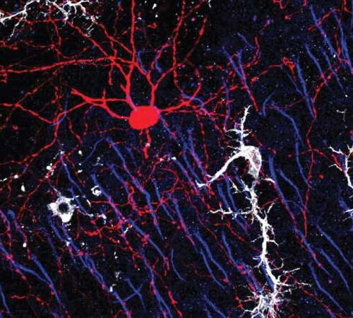 Uncovering how immune cells nurture brain connections