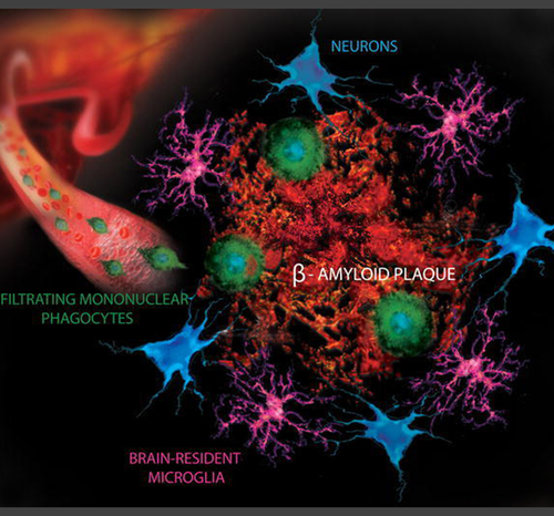 Could leaky blood vessels in the brain be a culprit in Alzheimer’s disease?