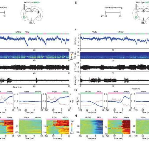 Dopamine found to be an initiator of REM sleep