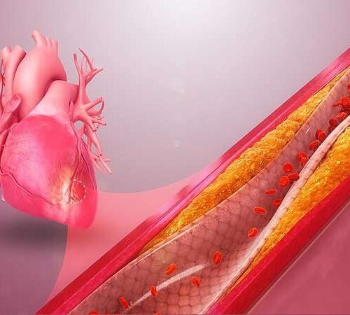 Scientists validate a low-risk diagnostic test for coronary artery disease