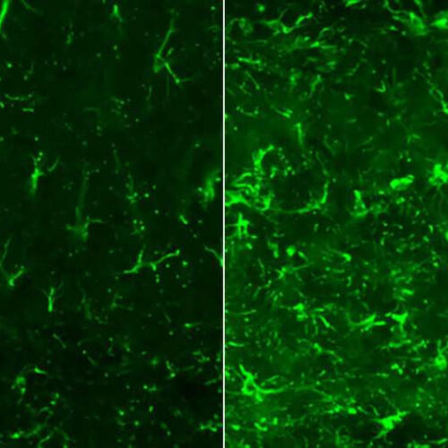 New strategy reduces brain damage in Alzheimer’s and related disorders in mice