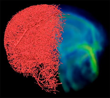 New Vascular Contrast for Clearer Blood Vessel Imaging