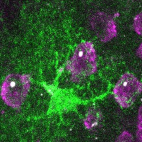 Huntington’s disease: Astrocytes to the rescue !