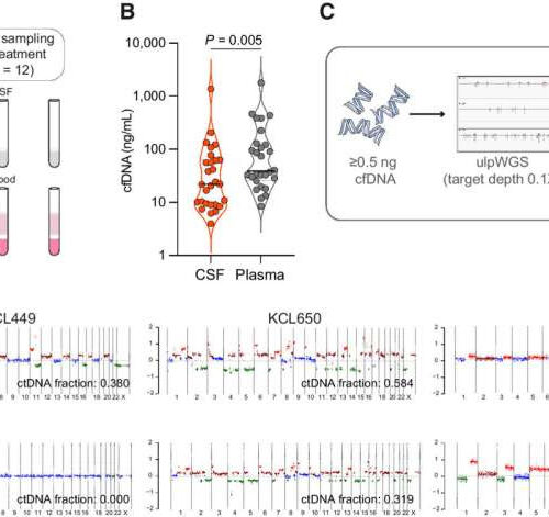 Spinal fluid analysis could speed up diagnosis of breast cancer spread