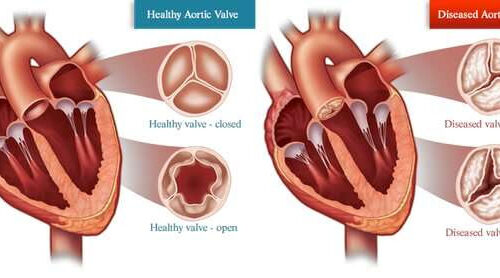 The sex of your cells matters when it comes to heart disease