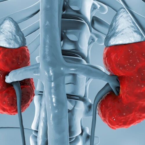 Risk Factors for Chronic Kidney Disease