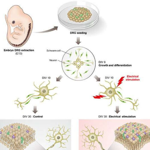 Electroceuticals for the treatment of diseases caused by loss of myelin