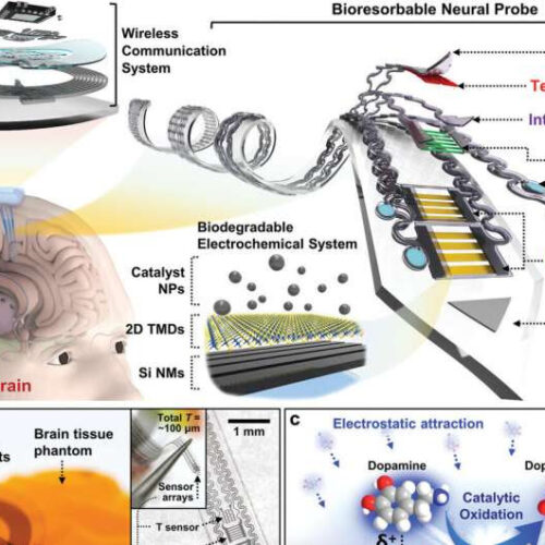 Biodegradable implant could help doctors monitor brain chemistry