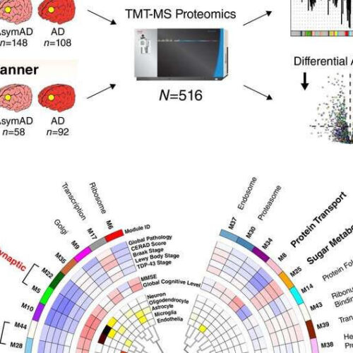 Study unveils new protein-related changes in the brain of patients with Alzheimer’s disease