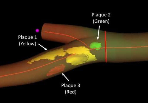 3D matrix ultrasound accurately identifies cardiovascular injury in healthy individuals