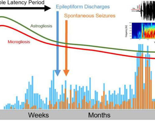 Researchers create breakthrough model for helping patients with post-traumatic epilepsy