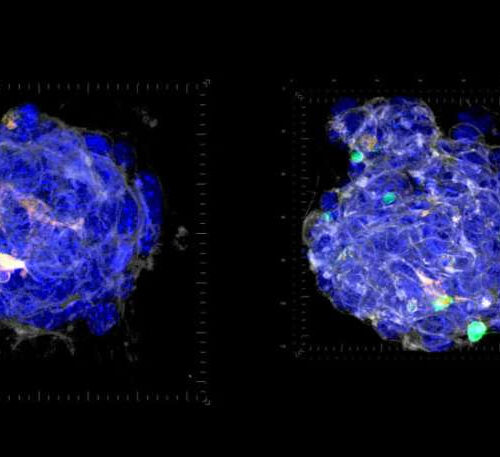 Study on tumor/immune cell interaction could impact cancer immunotherapies