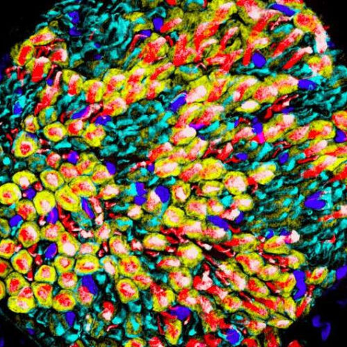 Using single-nuclei RNA sequencing to examine glial cells in peripheral nerves