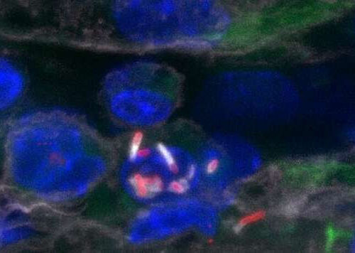 Discovery of an immune escape mechanism promoting Listeria infection of the central nervous system