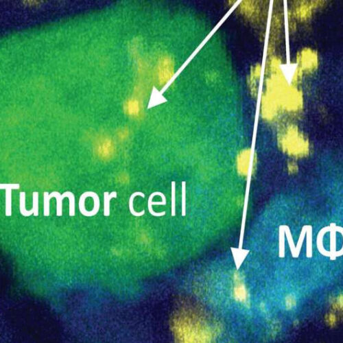 Novel therapeutic strategy shows promise against pancreatic cancer