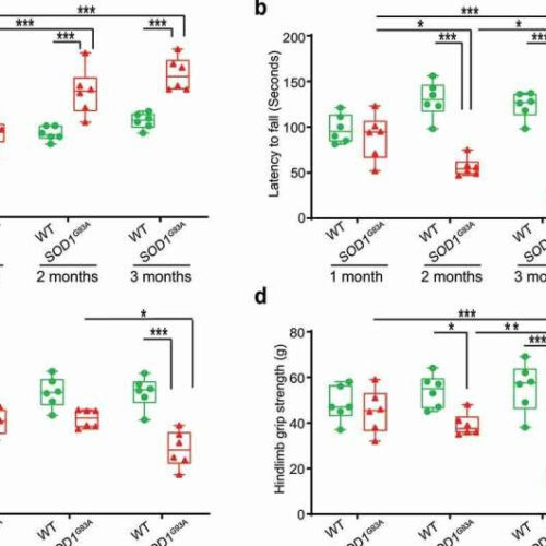 Could there be a link between the enteric neurons, gut microbiome and ALS?