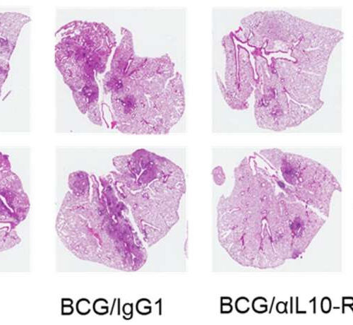 How to make the tuberculosis vaccine more effective