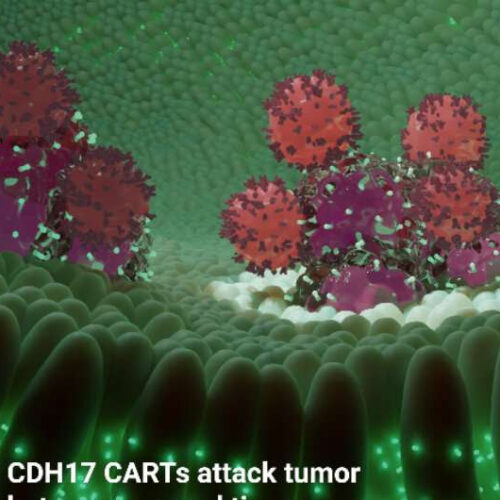 CAR T cells suppress GI solid tumor cells, without toxicity to healthy tissue, in preclinical research