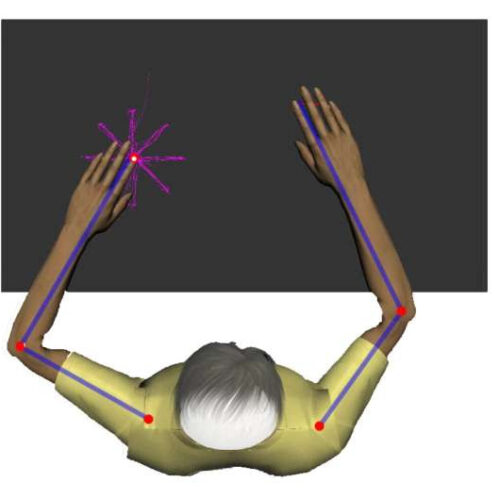 Brain stimulation shows beneficial effects for motor deficits following stroke