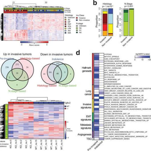 Researchers develop novel method to identify and treat aggressive early-stage lung cancers