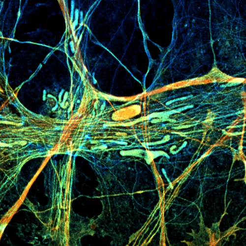 Limiting energy in neurons exacerbates epilepsy