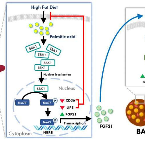 Protective factor found against excess lipid accumulation in obese mice livers: Potential fatty liver disease treatment