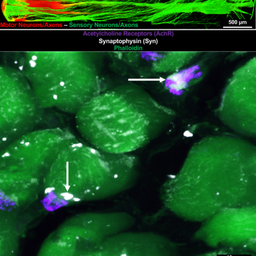 Penn Researchers Develop Injectable Microtissue to Preserve Muscle Function in Rats with Severed Sciatic Nerves