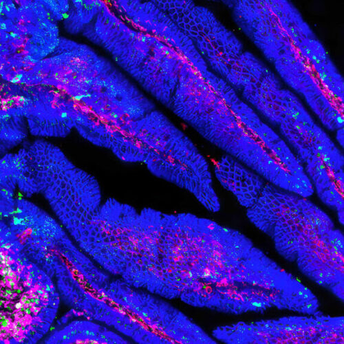 Gut microbiome and IBD: Intestinal ‘virome’ could be missing link