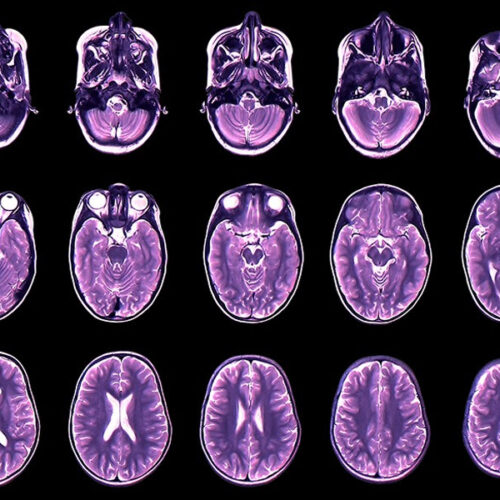 Your brain expands and shrinks over time — these charts show how