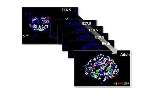 Scientists make new discoveries in the origin and ID of pancreatic endocrine cells