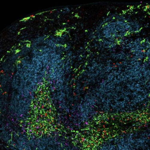 Immune system ‘sentinel’ cells key to maintaining and regulating response to immunotherapy