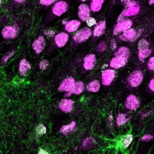 Newborn cells in the epileptic brain provide a potential target for treatment